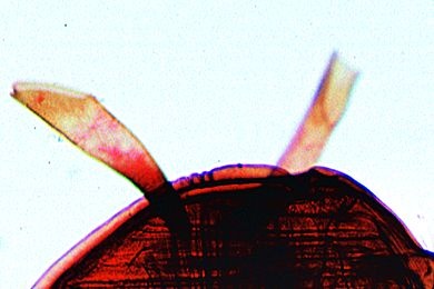Mikropräparat - Atemröhren der Puppe der Stechmücke (Cules), total