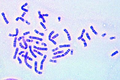 Mikropräparat - Chromosomen des Menschen aus Leukozytenkultur (weiblich) *