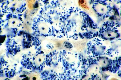 Mikropräparat - Mitochondrien in den Zellen der Leber oder Niere