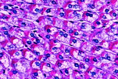 Mikropräparat - Glykogenspeicherung in den Leberzellen (Karminfärbung nach Best oder PAS-Reaktion)