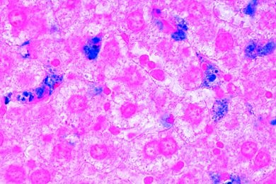 Mikropräparat - Phagozytose in den Kupfferschen Sternzellen der Leber