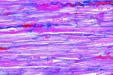 Mikropräparat - Herzmuskeln vom Säugetier, quer und längs