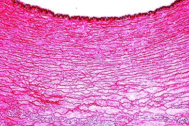 Mikropräparat - Arterie der Katze, quer. Färbung der elastischen Fasern