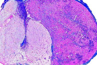 Mikropräparat - Hypophyse (Hirnanhangsdrüse) vom Schwein, sagittal längs. Adeno-und Neurohypophyse
