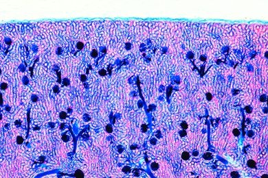 Mikropräparat - Niere, injiziert zur Darstellung der Blutgefäße, quer