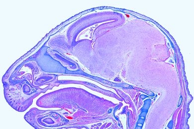 Mikropräparat - Junge Maus, Kopf hinter der Augenregion, quer. Gehirn
