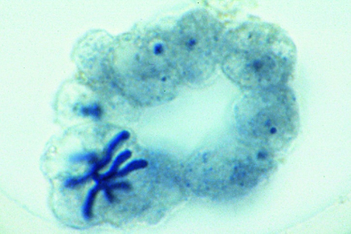 Mikropräparat - Ascaris megalocephala Embryologie. Uterus quer: Ältere...