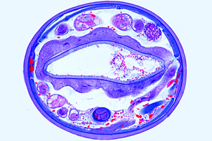 Mikropräparat - Ancylostoma duodenale, Männchen und Weibchen, quer