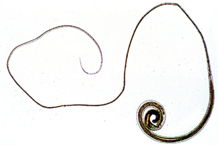 Mikropräparat - Trichuris trichiura, Peitschenwurm, total