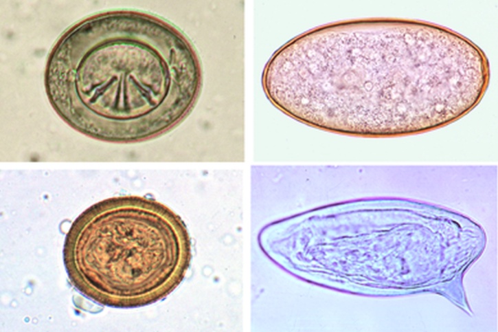 Mikropräparat - Wurmeier des Menschen, Mischpräparat mit vielen verschiedenen Arten