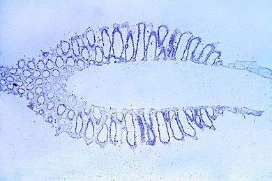 Mikropräparat - Sycon, Längsschnitt durch ganzes Tier mit Osculum, median