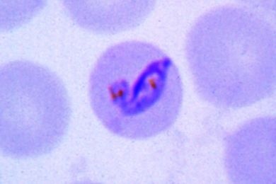 Mikropräparat - Plasmodium malariae, Malaria quartana, Blutausstrich