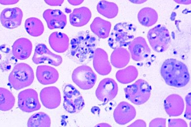 Mikropräparat - Plasmodium berghei, Malaria bei Nagetieren