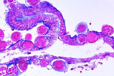 Mikropräparat - Plasmodium spec., Darm einer infizierten Anopheles-Mücke mit Oocysten *