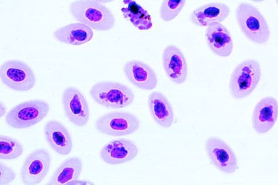 Mikropräparat - Plasmodium gallinaceum (Proteosoma), Geflügelmalaria...