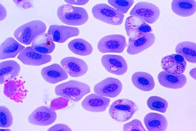 Mikropräparat - Haemoproteus columbae, Malaria bei Tauben, Blutausstrich