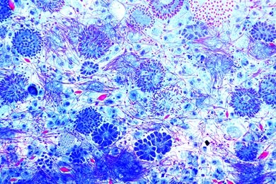 Mikropräparat - Monocystis lumbrici, Ausstrich aus den Samenblasen des Regenwurms