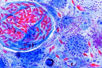 Mikropräparat - Monocystis lumbrici, Schnitt durch die Samenblasen des Regenwurms