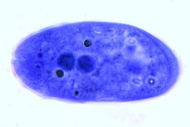 Mikropräparat - Balantidium coli, Darmparasit des Menschen, Ausstrich mit vegetativen Formen