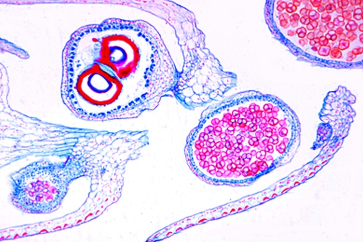 Mikropräparat - Selaginella, Sporophyllstand mit Mikro- und Makrosporangien, längs