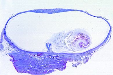 Mikropräparat - Cysticercus cellulosae, Finne von Taenia solium