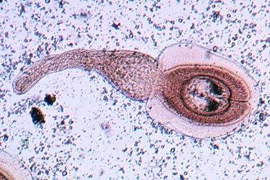 Mikropräparat - Hymenolepis diminuta, Cysticercoid (Larvenstadium), total