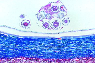 Mikropräparat - Echinococcus granulosus, Cystenwand mit Scolices, Schnitt