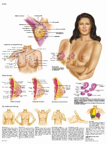 Anatomische Lehrtafel, Die weibliche Brust- Selbstuntersuchung - Anatomie, Pathologie