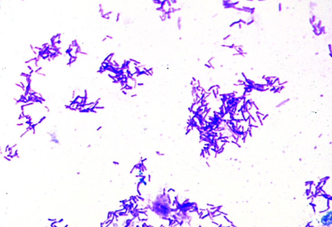 Микропрепарат бактерий. Протей мирабилис в мазке. Протей бактерия микроскопия. Протей вульгарис микроскопия.