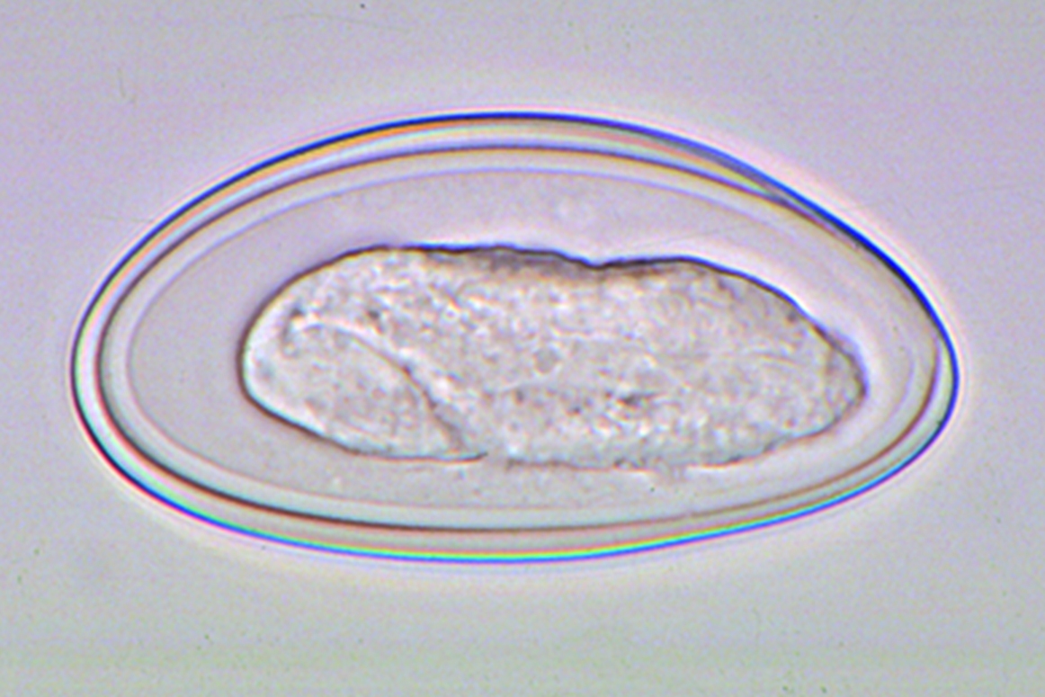 enterobius vermicularis eier