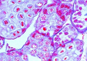 Mikropräparat - Astacus, Flußkrebs, Hoden quer, Spermiogenese