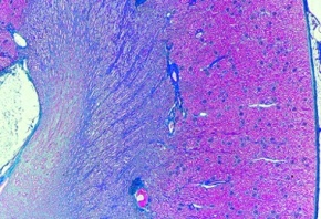 Mikropräparat - Niere der Katze, quer, Schnitt durch Rinde und Mark