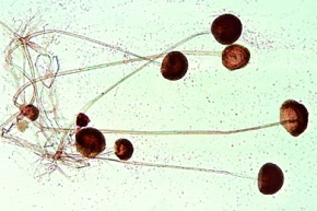 Mikropräparat - Mucor mucedo, Kopfschimmel. Myzel und Sporangien