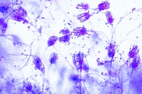 Mikropräparat - Penicillium, Pinselschimmel. Myzel und Konidiophoren