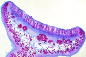 Mikropräparat - Xanthoria, Flechte, Apothezium mit Asci und Sporen, quer