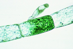 Mikropräparat - Oedogonium, Grünalge. Unverzweigte Fäden