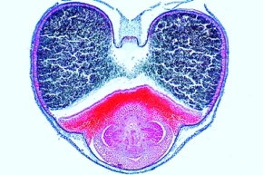 Mikropräparat - Triticum, Weizen, Samenkorn quer, Endosperm und Embryo