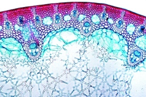 Mikropräparat - Juncus, Binse, Stamm mit Sternzellen im Mark, quer