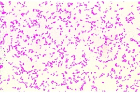 Mikropräparat - Eberthella typhi, Typhuserreger