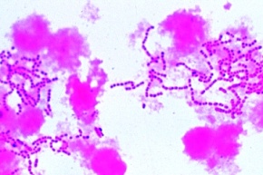 Mikropräparat - Streptococcus pyogenes, Sepsis, Ausstrich mit kurzen Ketten