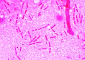 Mikropräparat - Bacillus anthracis, Milzbranderreger, Ausstrich von Kultur