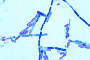 Mikropräparat - Clostridium septicum, Pararauschbrand, Ausstrich