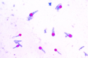 Mikropräparat - Clostridium tetani, Wundstarrkrampf, Ausstrich