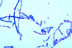 Mikropräparat - Clostridium perfringens, Erreger des Gasbrands, Ausstrich