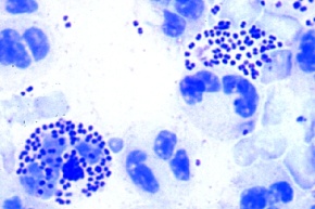 Mikropräparat - Neisseria gonorrhoeae (Gonokokken), Trippererreger *