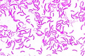 Mikropräparat - Rhodospirillum rubrum, farbstoffbildende Fäulniserreger
