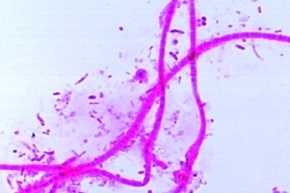 Mikropräparat - Sphaerotilus natans, Abwasserbakterium, lange Ketten mit Schleimhüllen