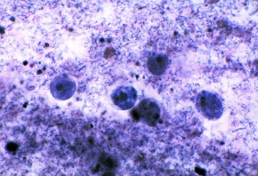 Mikropräparat - Entamoeba histolytica, Amöbenruhr, Ausstrich oder Schnitt