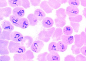 Mikropräparat - Babesia canis, Erreger der Piroplasmose, Blutausstrich
