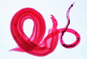 Mikropräparat - Schistosoma mansoni, Erreger der Bilharziose des Menschen